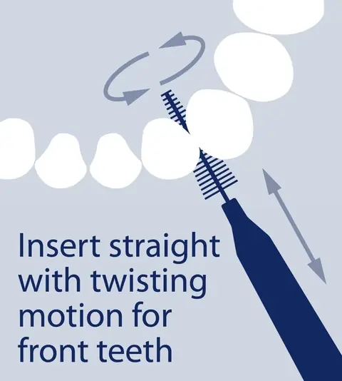 Diagram: insert the brush straight between the front teeth with a gentle twisting motion