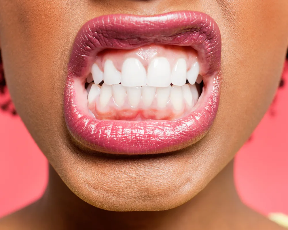 A close-up of a bright smile